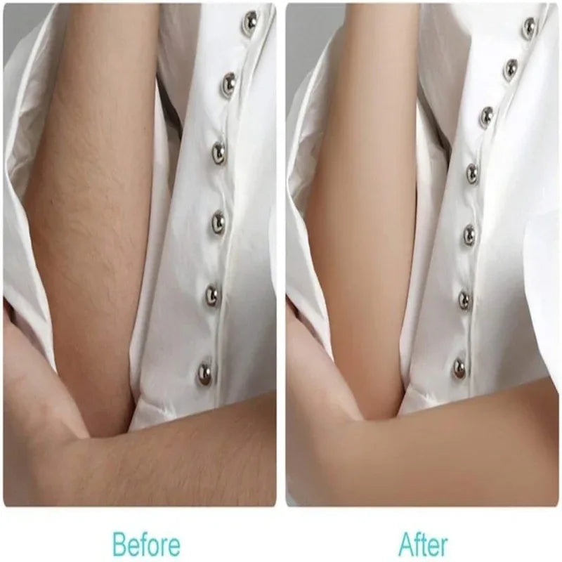 Instant And Pain Free Hair Removing Machine - Prozone