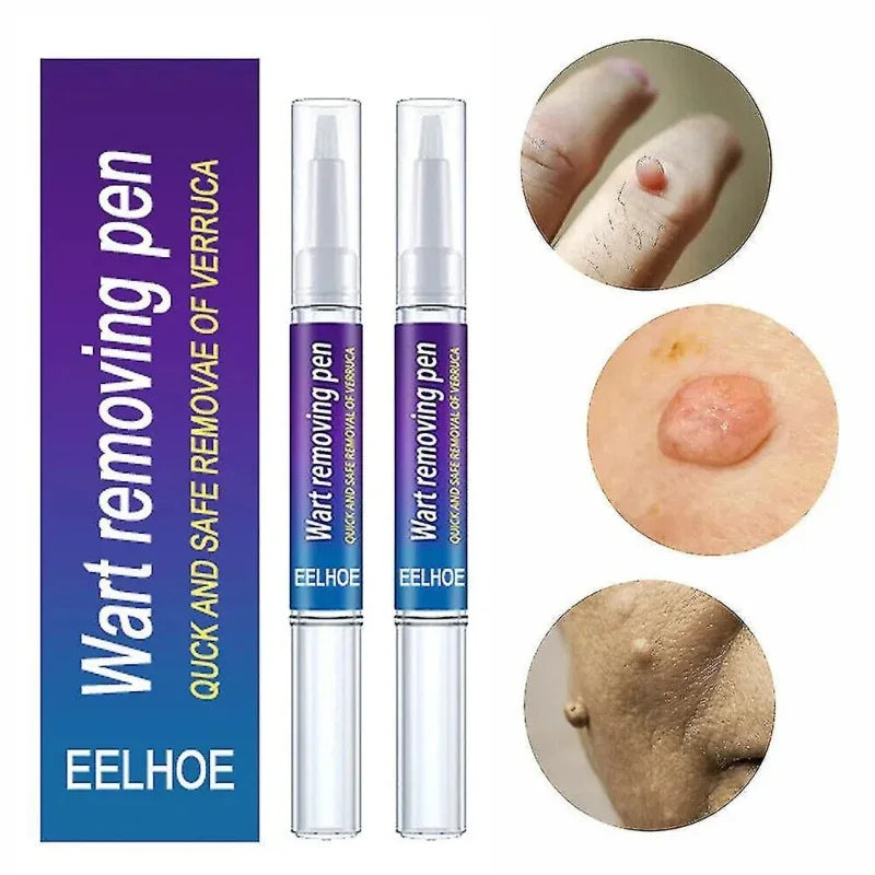 Warts Liquid Pen Woman Skin moles Remove Black Dots - Prozone