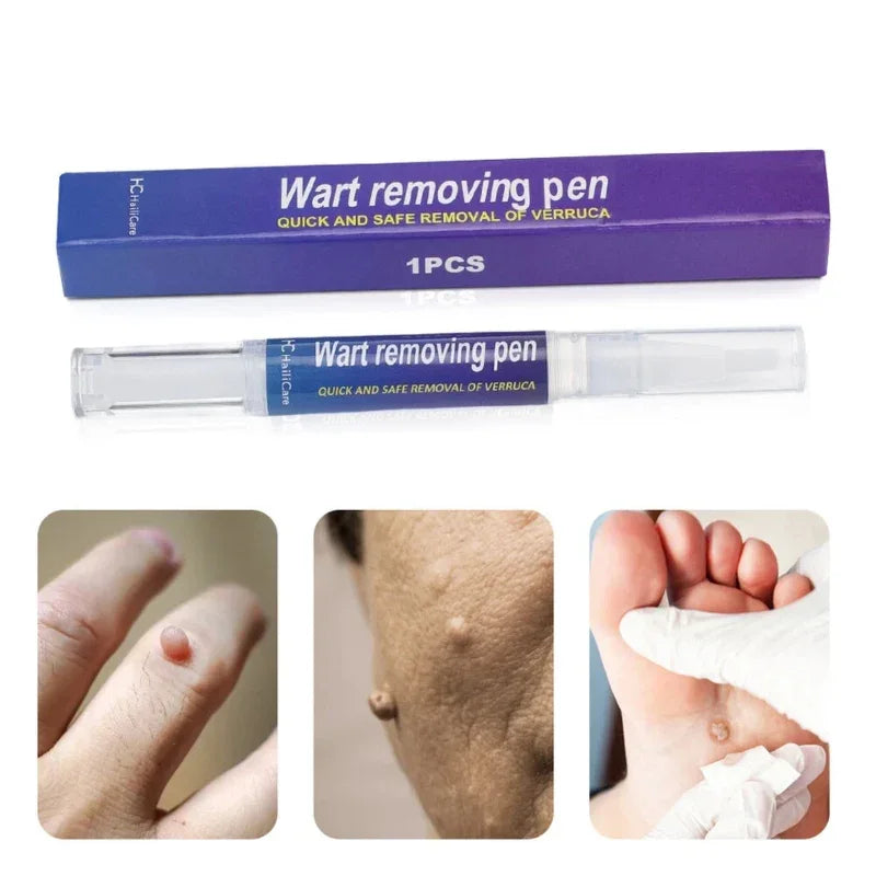 Warts Liquid Pen Woman Skin moles Remove Black Dots - Prozone