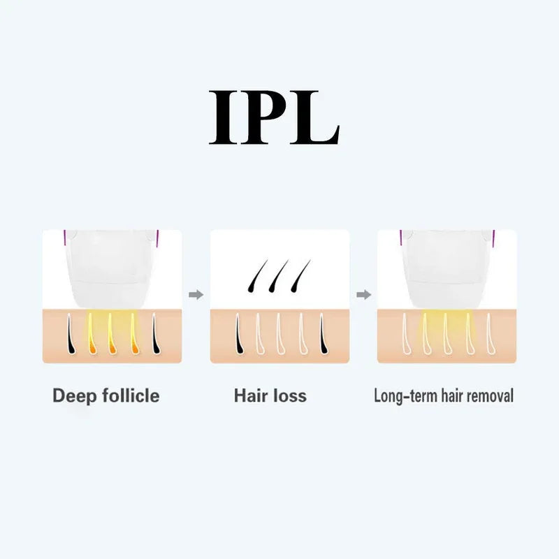 Umate ipl digital hair removal machine - Prozone