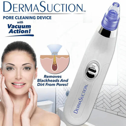 Derma suction cell operated black head remover - Prozone