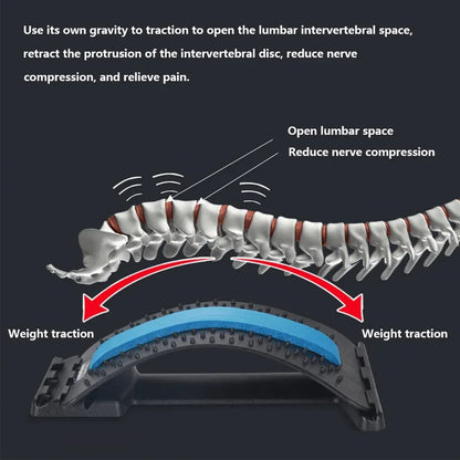 Back acupressure stretcher - Prozone