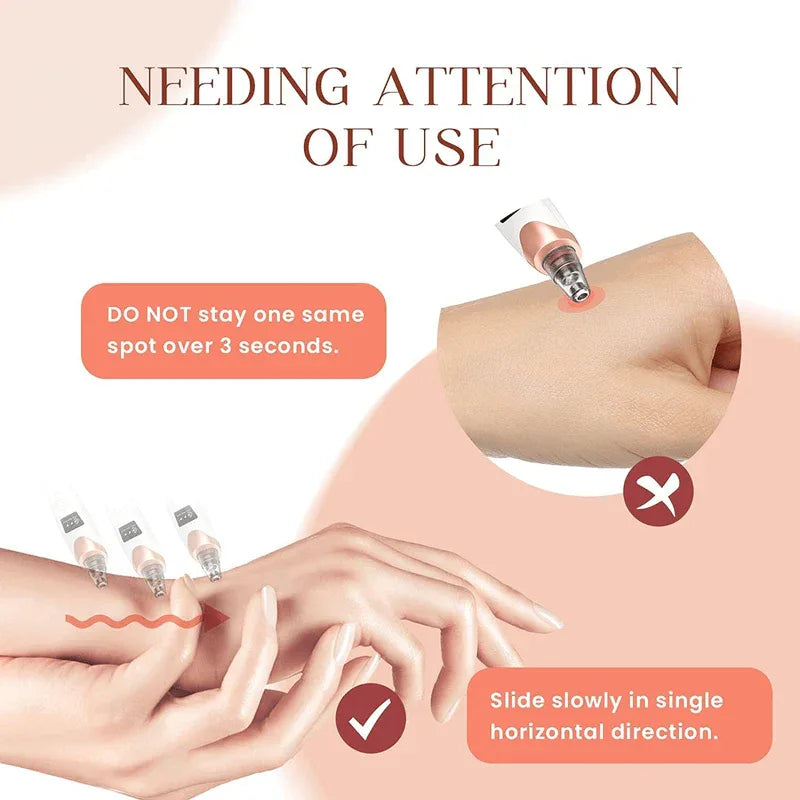 Newest blackhead remover pore vacuum - Prozone
