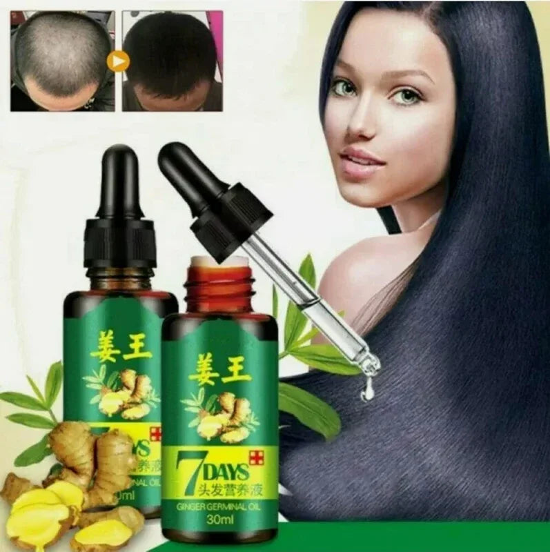 Ginger hair growth essence 7 days germinal hair growth serum - Prozone