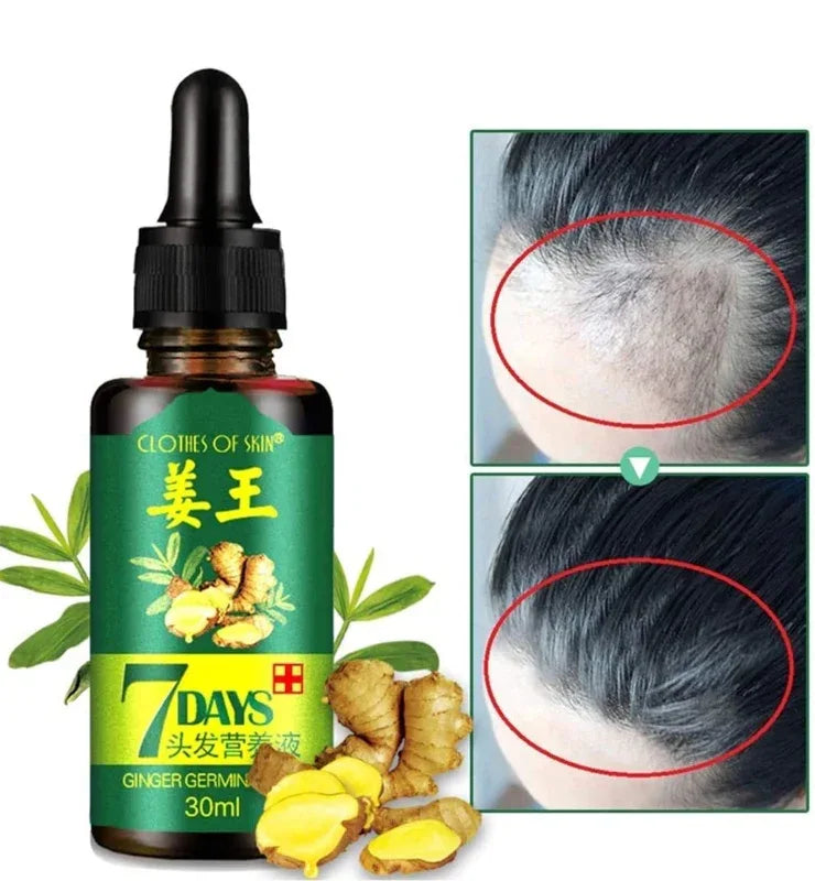 Ginger hair growth essence 7 days germinal hair growth serum - Prozone