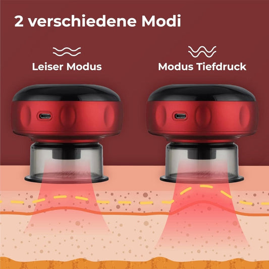 Cupping Therapy Machine Electric - Prozone