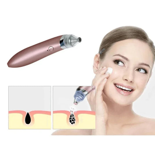 Blackhead remover- pore facial cleanser beauty machine - Prozone