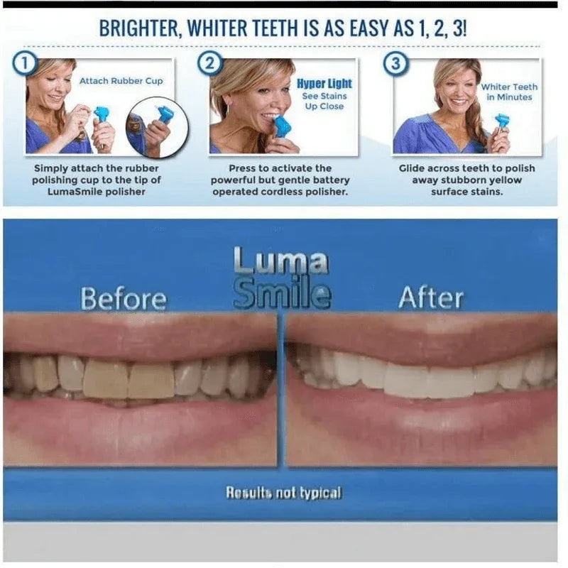 Dental teeth whitener- teeth stain remover - Prozone