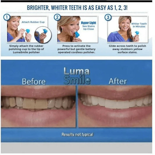Dental teeth whitener- teeth stain remover - Prozone
