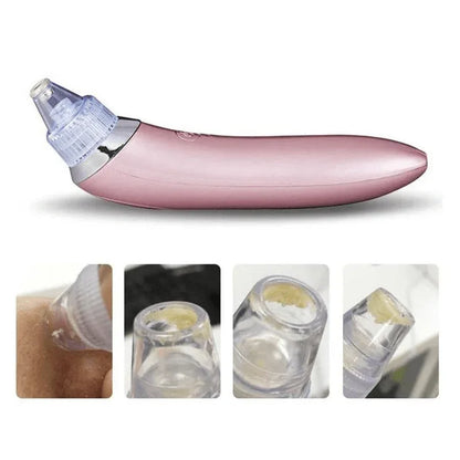Blackhead remover- pore facial cleanser beauty machine - Prozone