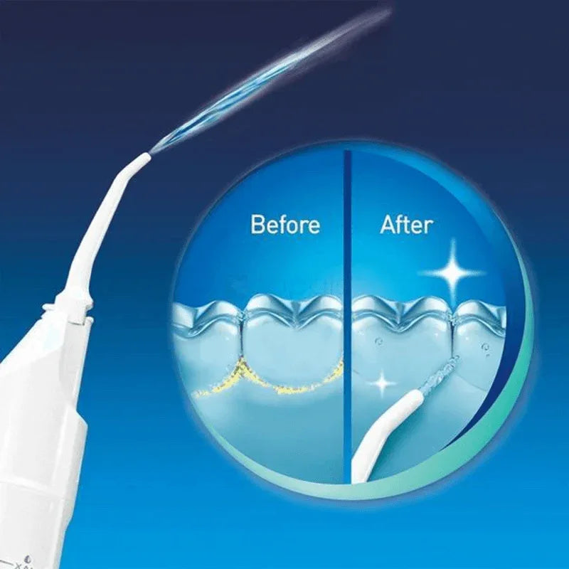 Power floss - air powered dental water jet - Prozone