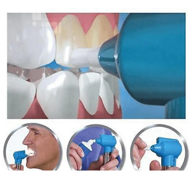 Dental teeth whitener- teeth stain remover - Prozone