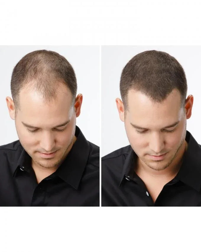 Caboki hair fiber - Prozone