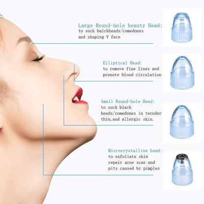 Electric suction blackhead remover pore cleanser - Prozone