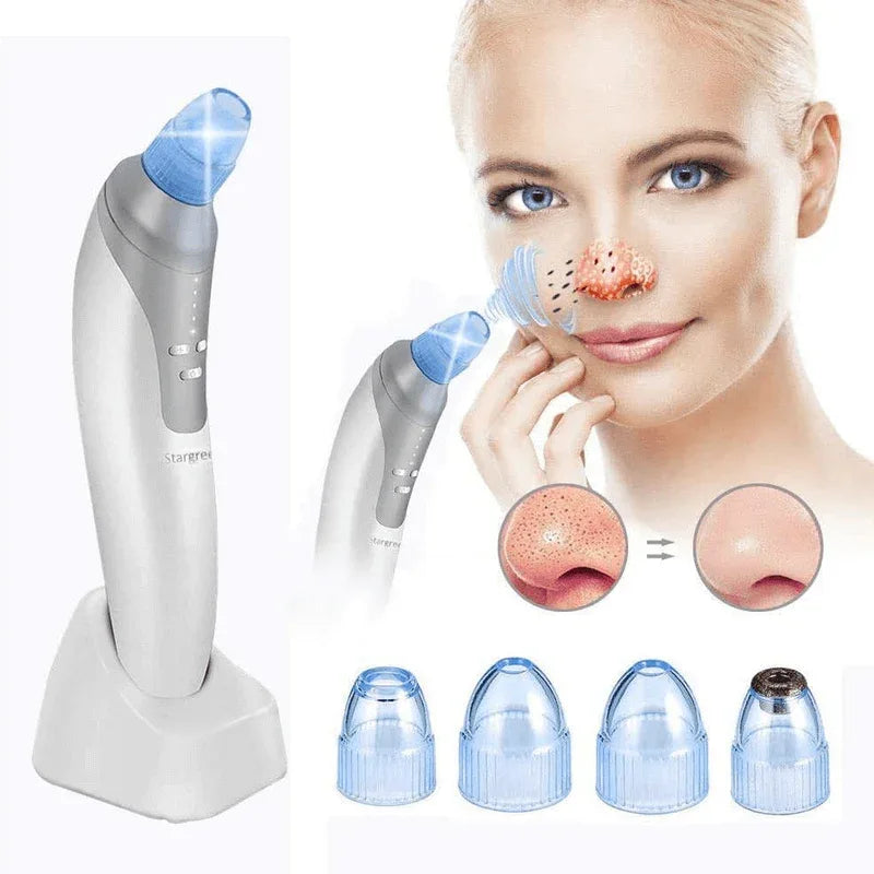 Electric suction blackhead remover pore cleanser - Prozone
