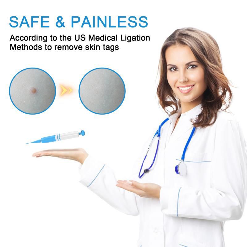 Skin Tag Remover - Prozone